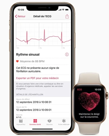 Crise cardiaque évitée, merci l&#039;Apple&nbsp;Watch